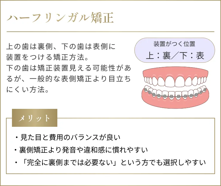 ハーフリンガル矯正